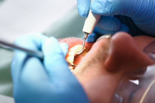 Best Emergency Broken Tooth Repair in Monterey, TN